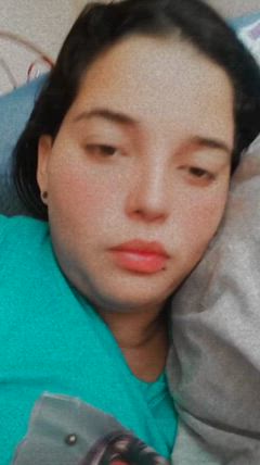 Gordinalgona - Foto 4d131863-fa98-4234-af1d-61e6c9122874